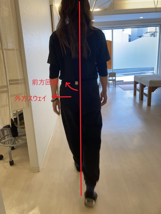 脚の付け根の痛みが劇的によくなる 大阪門真市のグローインペイン治療院 たかはし自然整体 整骨院